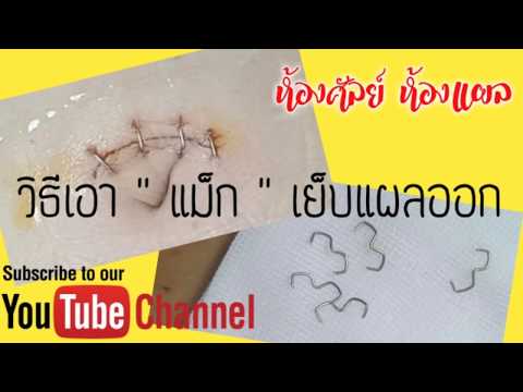 คลิกเพื่อดูคลิปวิดีโอ