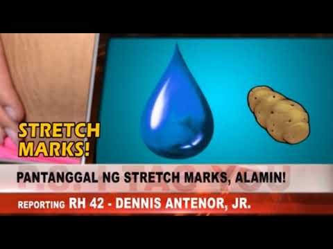 Pantalon slimming Mawalan ng timbang pagkatapos ng 40 kuwento