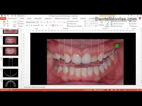 Digital Smile Design - Part 2/4. Кристиан Кочман