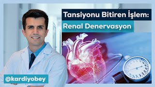 Hipertansiyon Tedavisinde Yeni Yöntem: Renal Denervasyon