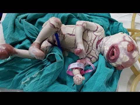 , title : 'Dünyanın En Sıradışı 10 Bebeği - Doktorlar ŞOK Oldu !'