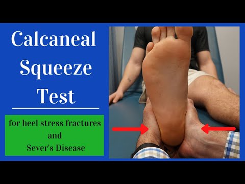 Metatarsalgia and Morton s Neuroma Evaluation and Treatment