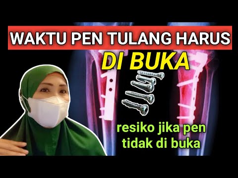 KAPAN WAKTU BUKA PEN TULANG DAN RESIKO JIKA PEN TIDAK DI BUKA
