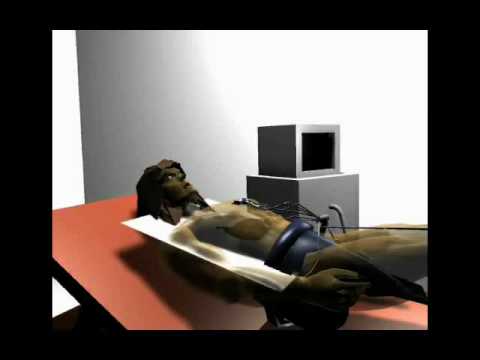 ECG Interpretation - ECG Lead Perspectives (Section 1, Part 4)