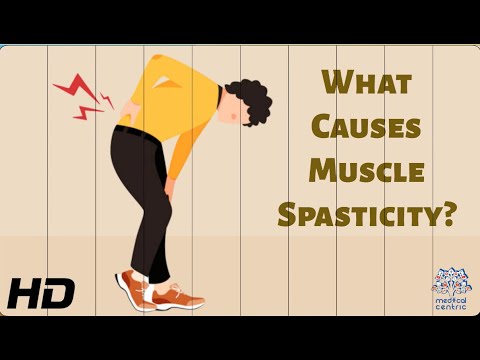 Muscle Spasticity: What's Really Going on and How to Treat It