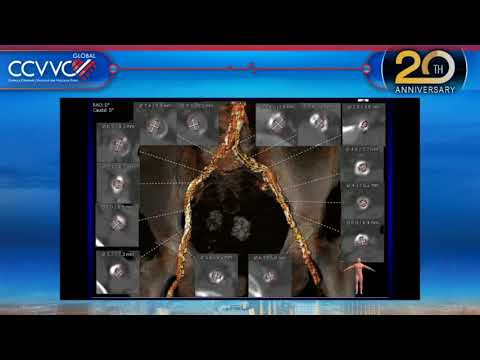 Live Case 3 - Evolut-PRO TAVR - CCVVC 2017