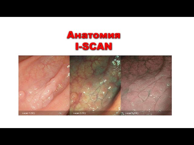 Подробный разбор режимов i-scan за 15 минут или Анатомия i-scan 