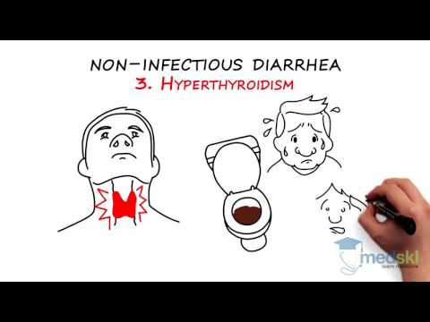 Gastroenterology - Acute Diarrhea: By John Kargbo M.D.