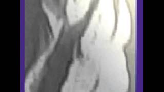 arsonist caught on tape