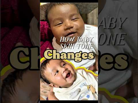 How baby skin tone changes 0-4 months #baby #skintone #shortsfeed #shorts #changes #babytone #mom