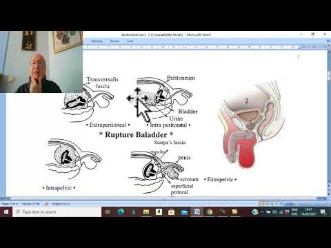 Trauma in Arabic 35 ( Intra-peritoneal Injury of Urinary Bladder ) , by Dr. Wahdan .