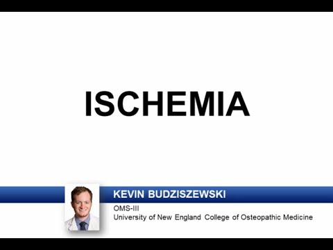 USMLE-Rx Express Video of the Week: Ischemia