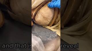 Layers of the Human Head