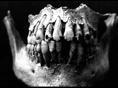Kreeps - Devil's Teeth