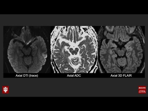 Brain Case of the Day 28