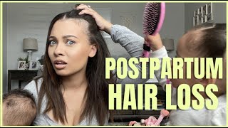 I'M BASICALLY GOING BALD: POSTPARTUM HAIR LOSS | Brittney Gray