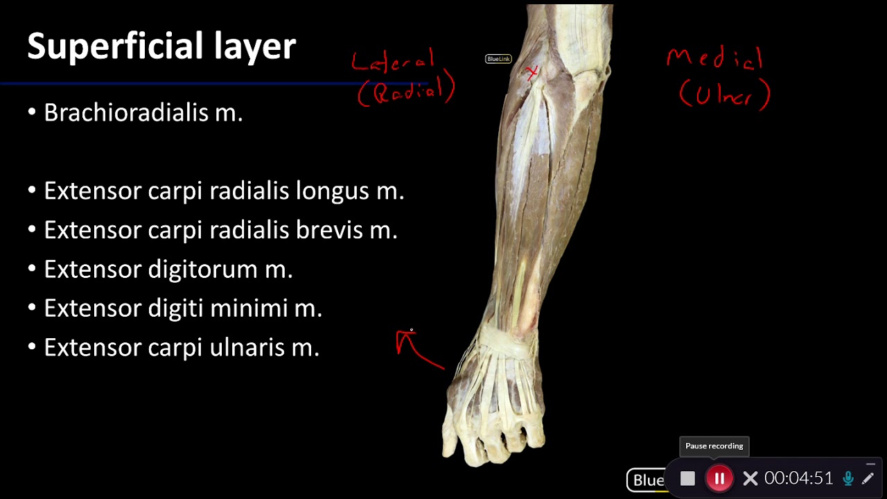 Posterior Compartment of Forearm: Overview of Upper Limb - Dissection Supplement