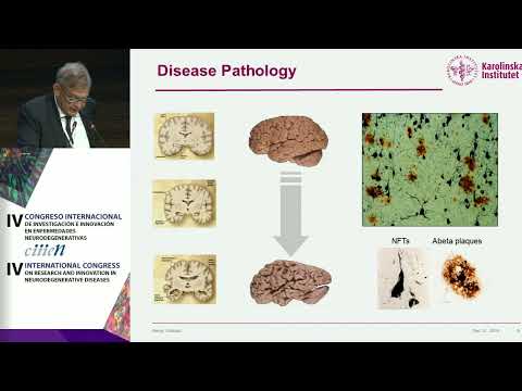 Bengt Winblad: Alzheimer´s Disease - Present and future Treatment Strategies