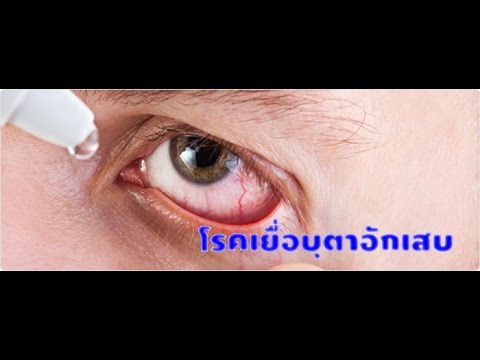 เมนูอาหารสำหรับกลาก กลากบนใบหน้าของผม