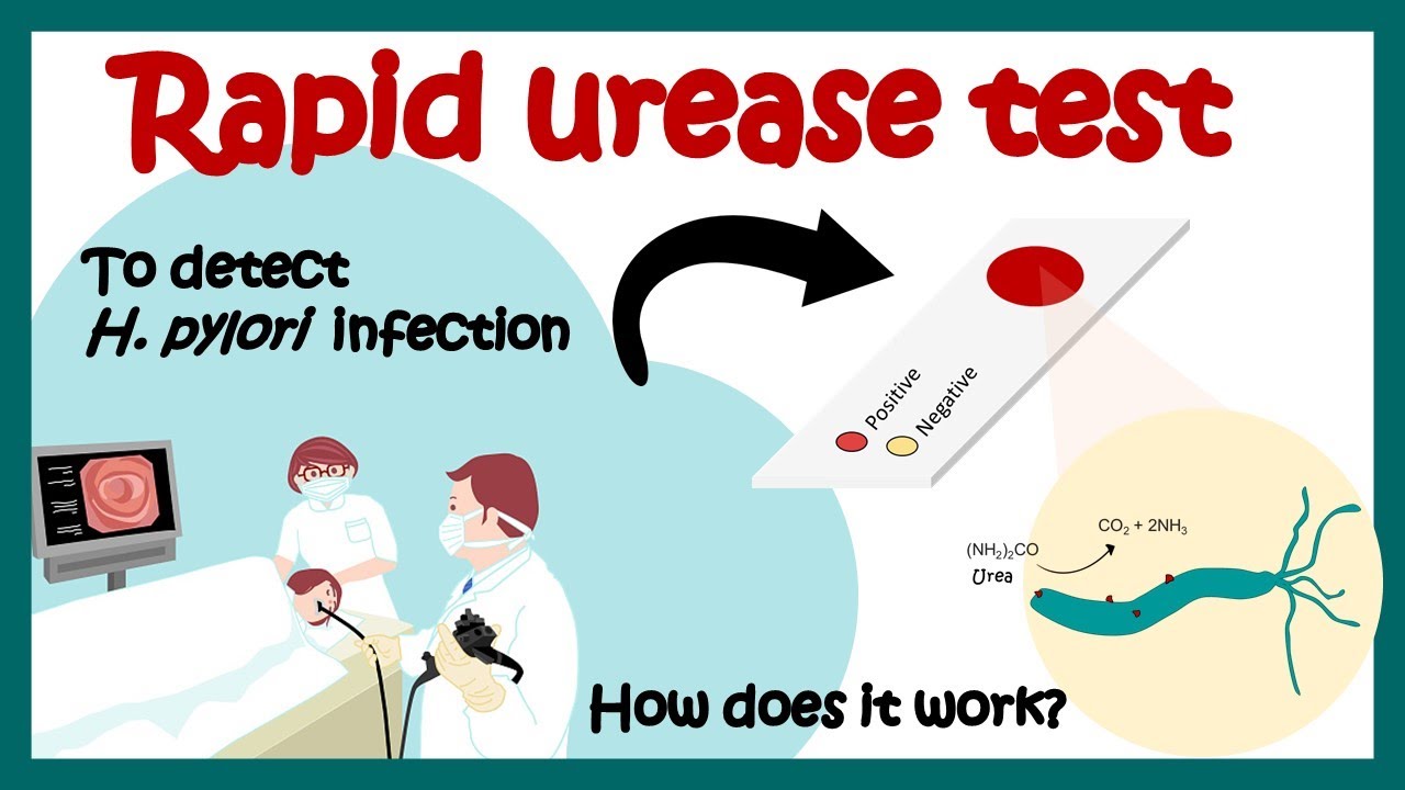 What does a positive urease test mean? Tipseri