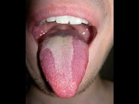 Jaki rodzaj choroby, jeśli penis jest mały Ile jest wzrost członka w Krasnojarsku