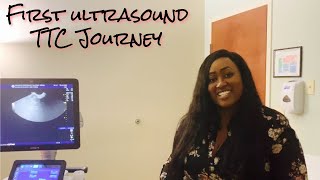 First ultrasound| Egg Count| HSG Test: Did it hurt!?| Lesbian TTC Journey