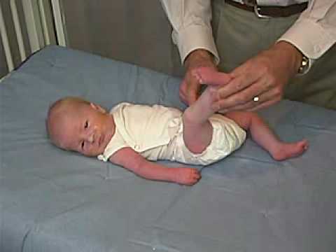 neurology exam: newborn-abnormal: Tone - Leg Traction