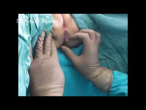 problem in young girl child     