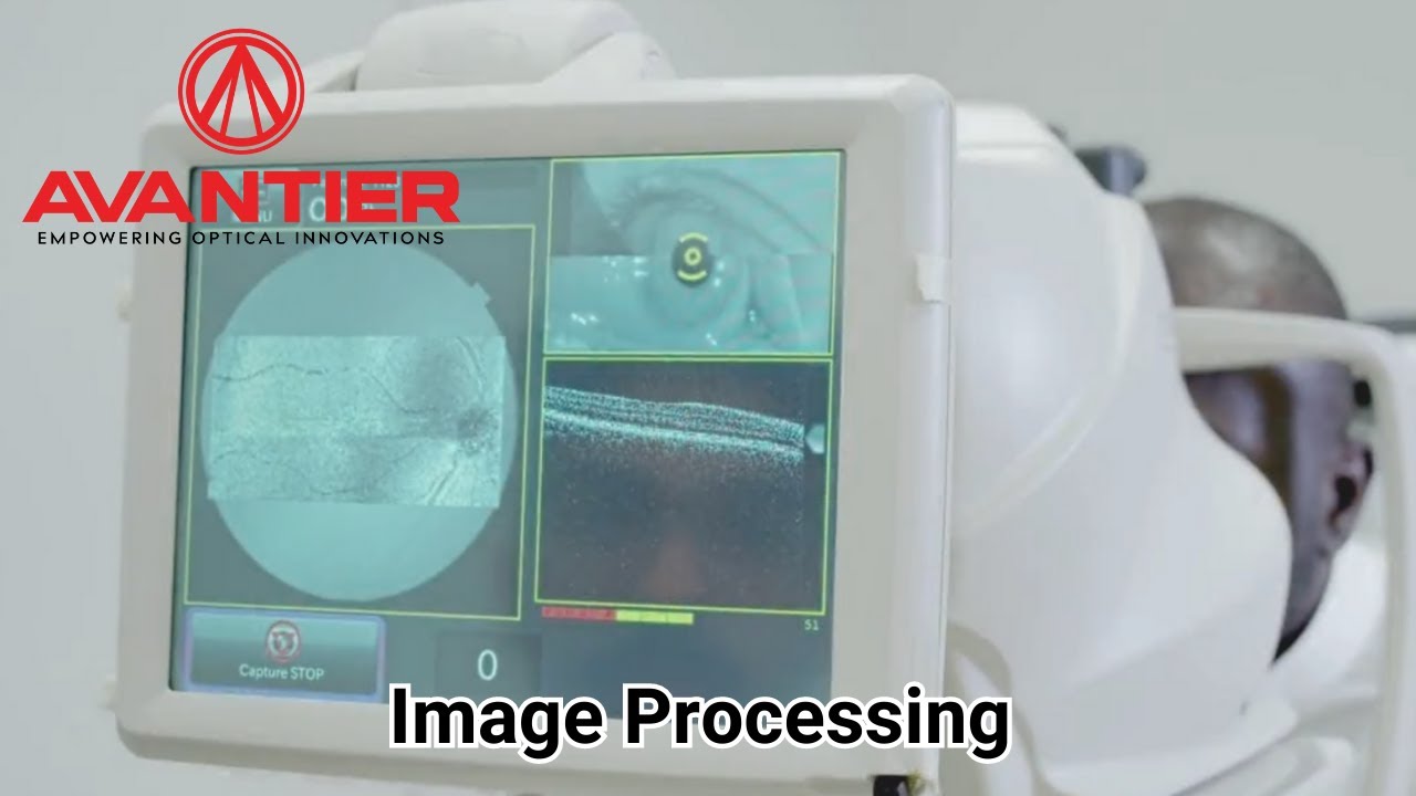 Image Analysis & Processing at Avantier