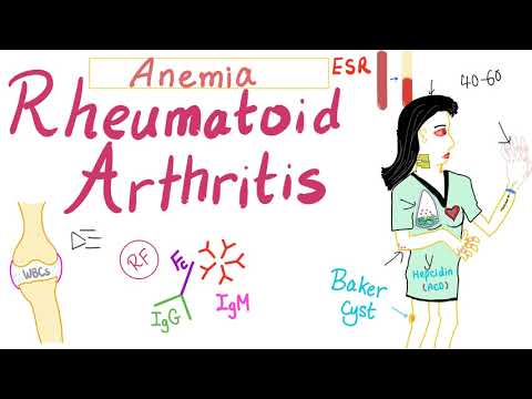 Rheumatoid Arthritis (RA) - Anemia and Rheumatoid - Rheumatology Series (Part 7)