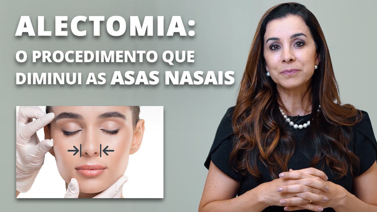 Você já ouviu falar em ALECTOMIA? O procedimento que diminui a abertura do nariz