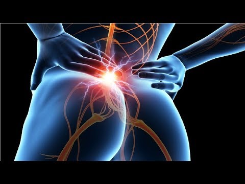 Osteochondrose der Halswirbelsäule und Panikattacken Bewirkt, dass Flüssigkeitsansammlung im Kniegelenk