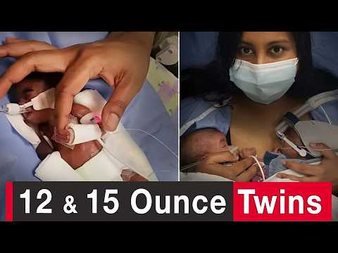 World’s Most Premature Twins: We Believed God for a Miracle - Family & Relationships, Pregnancy Complications, Testimonies - 100huntley