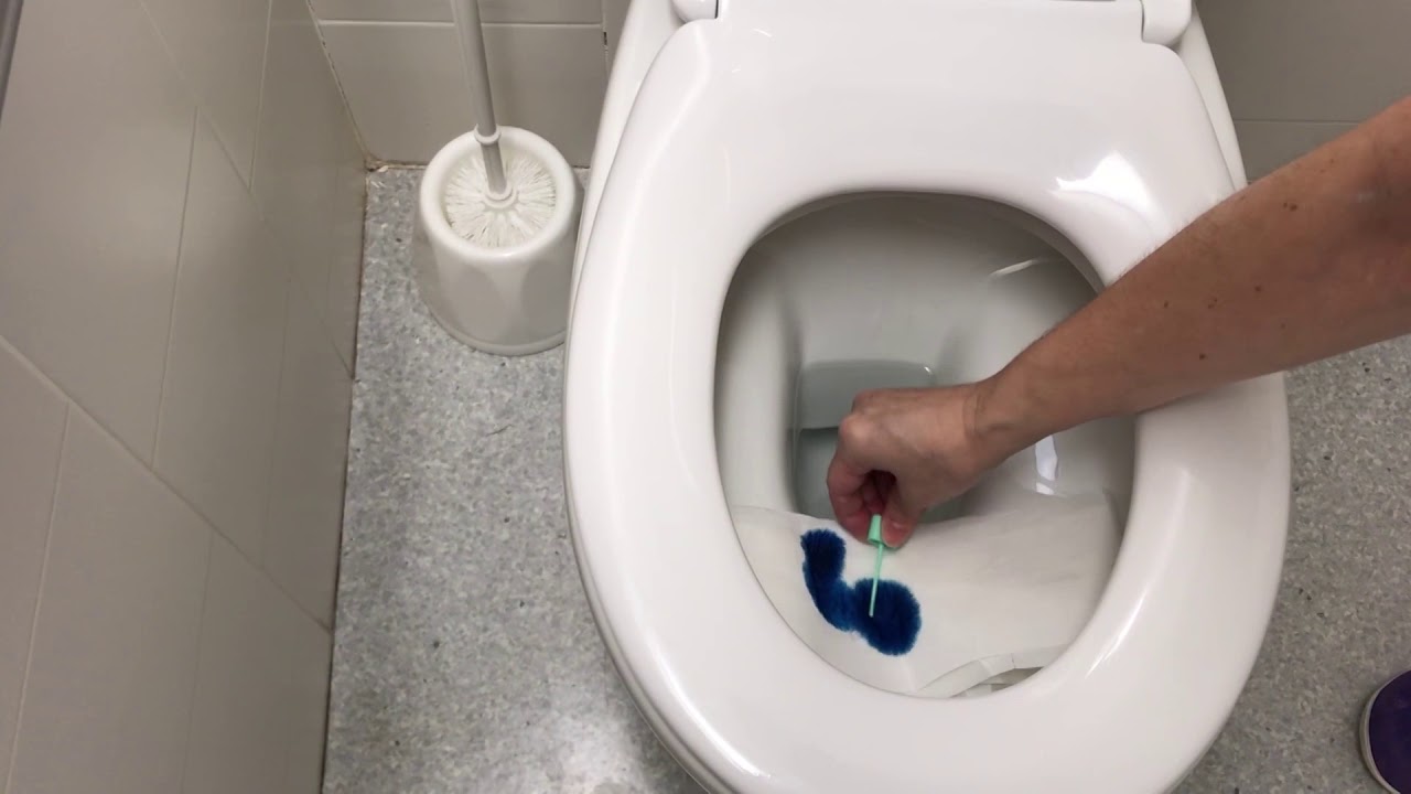 Watch Prova de sang oculta en femtes / Prueba de sangre oculta en heces Now Prova de sang oculta en femtes / Prueba de sangre oculta en heces