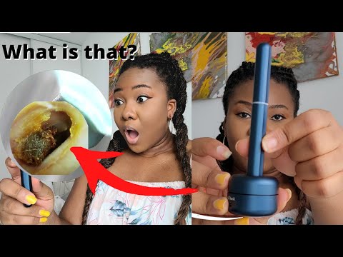 I Tried Removing My Ear Wax With A Camera |CLEANING MY...
