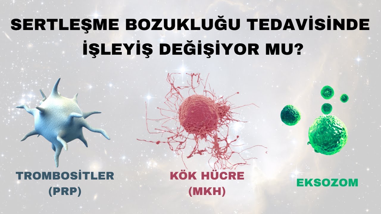 Sertleşme Bozukluğunda PRP , Eksozom ,Kök Hücre Tedavisi