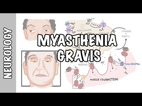 Myasthenia Gravis - symptoms, pathophysiology, investigations, treatment