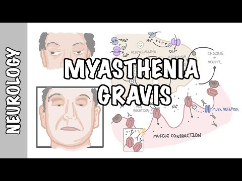 Miastenia Gravis - objawy, patofizjologia, diagnostyka, leczenie