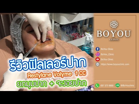 ฉีด ฟิลเลอร์ ปาก