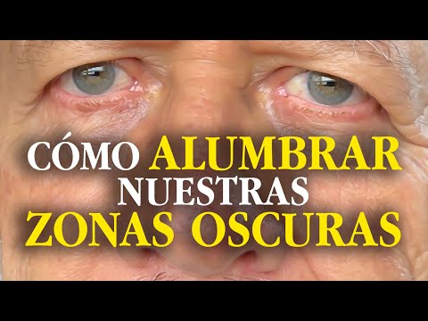 By knowing your dark areas you can shine with new light - Reflection