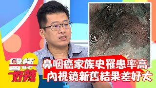 鼻咽癌家族史罹患率高！內視鏡新舊結果差好大？！【#醫師好辣】20210518 part2 EP1151 鄭丞傑 吳昭寬