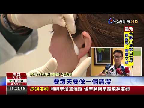 耳洞增生肉芽包耳飾 男大生開刀取出