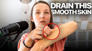 The REAL Cause of Cellulite (It’s Not What You Think)