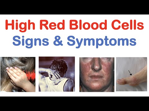 High Red Blood Cells (Polycythemia) Signs & Symptoms (& Why They Occur)