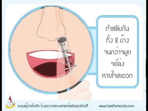 ไซนัสอักเสบ