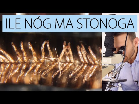 Nogi stonogi i kryształy kwasu