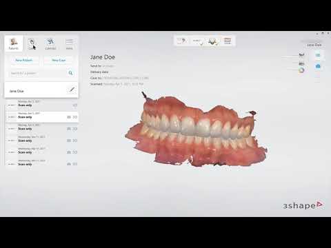 Exporting STL file from TRIOS
