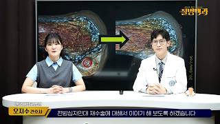 '이걸' 모르면 수술 실패 합니다! 전방십자인대 재수술, 자가건 이식이 유리한 이유는?