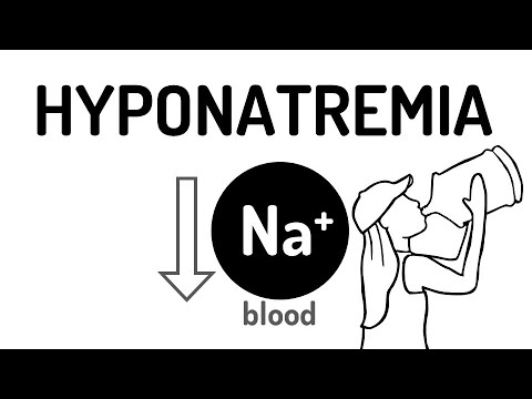HYPONATREMIA made easy!!