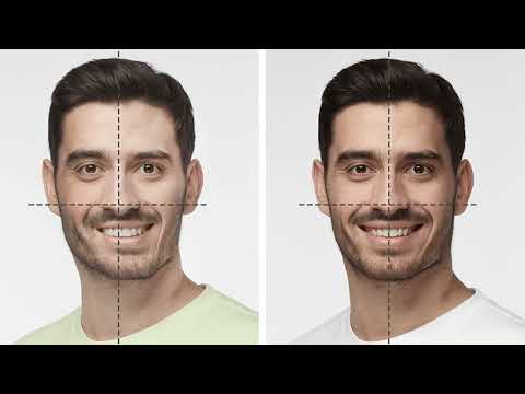 Asimetría facial: Qué es, tipos y tratamientos.